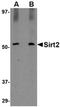 Sirtuin 2 antibody, orb74946, Biorbyt, Western Blot image 