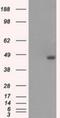 Branched Chain Keto Acid Dehydrogenase Kinase antibody, NBP1-47664, Novus Biologicals, Western Blot image 