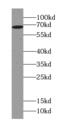 Ubiquitin-associated and SH3 domain-containing protein A antibody, FNab09150, FineTest, Western Blot image 