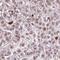 Transmembrane Protein 177 antibody, HPA053816, Atlas Antibodies, Immunohistochemistry paraffin image 
