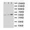 Pyruvate Kinase M1/2 antibody, LS-C313177, Lifespan Biosciences, Western Blot image 