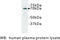 Complement C3 beta chain antibody, MBS355079, MyBioSource, Western Blot image 