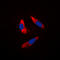 Ribosomal Protein S6 Kinase B1 antibody, LS-C358316, Lifespan Biosciences, Immunofluorescence image 