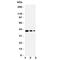 Translocation Associated Membrane Protein 2 antibody, R31118, NSJ Bioreagents, Western Blot image 