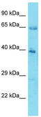 Kelch Like Family Member 12 antibody, TA337246, Origene, Western Blot image 