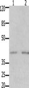 GDNF Family Receptor Alpha 3 antibody, CSB-PA037992, Cusabio, Western Blot image 