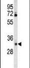 Carbonic Anhydrase 6 antibody, PA5-26781, Invitrogen Antibodies, Western Blot image 