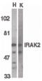 Interleukin 1 Receptor Associated Kinase 2 antibody, PA5-19917, Invitrogen Antibodies, Western Blot image 