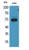 Dipeptidyl Peptidase 7 antibody, A08338, Boster Biological Technology, Western Blot image 