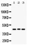 Ataxin 3 antibody, PB9423, Boster Biological Technology, Western Blot image 