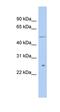 Tetratricopeptide Repeat Domain 8 antibody, orb330579, Biorbyt, Western Blot image 