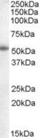 Cytochrome P450 Family 19 Subfamily A Member 1 antibody, PA5-18880, Invitrogen Antibodies, Western Blot image 