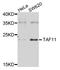TATA-Box Binding Protein Associated Factor 11 antibody, STJ110243, St John