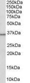 Hydroxysteroid 11-Beta Dehydrogenase 1 antibody, GTX89627, GeneTex, Western Blot image 