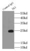 Thymidine Kinase 1 antibody, FNab08718, FineTest, Immunoprecipitation image 