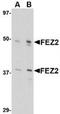 Fasciculation and elongation protein zeta-2 antibody, TA306504, Origene, Western Blot image 