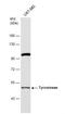 Tyrosinase antibody, NBP2-20770, Novus Biologicals, Western Blot image 