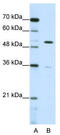 Zinc Finger Protein 485 antibody, TA345525, Origene, Western Blot image 