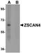 Zinc Finger And SCAN Domain Containing 4 antibody, orb94363, Biorbyt, Western Blot image 