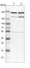 CDC42 Binding Protein Kinase Beta antibody, NBP1-81440, Novus Biologicals, Western Blot image 