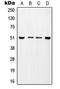 Transcriptional Adaptor 2A antibody, GTX55173, GeneTex, Western Blot image 