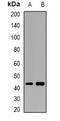 Actin Related Protein 3B antibody, abx142020, Abbexa, Western Blot image 