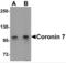 Coronin 7 antibody, NBP2-81790, Novus Biologicals, Western Blot image 