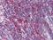 Metadherin antibody, MA5-15564, Invitrogen Antibodies, Immunohistochemistry frozen image 