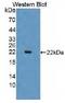 TIMP Metallopeptidase Inhibitor 3 antibody, MBS2001904, MyBioSource, Western Blot image 