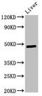 Pyruvate Dehydrogenase Kinase 3 antibody, LS-C671881, Lifespan Biosciences, Western Blot image 