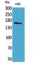 Laminin Subunit Gamma 2 antibody, PA5-51110, Invitrogen Antibodies, Western Blot image 