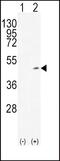 Alcohol Dehydrogenase 1C (Class I), Gamma Polypeptide antibody, PA5-25448, Invitrogen Antibodies, Western Blot image 