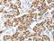 Annexin A10 antibody, LS-C404518, Lifespan Biosciences, Immunohistochemistry paraffin image 