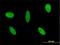 GLI Family Zinc Finger 3 antibody, H00002737-M01, Novus Biologicals, Immunofluorescence image 