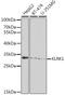 Killer Cell Lectin Like Receptor K1 antibody, GTX33358, GeneTex, Western Blot image 