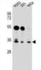 GLIPR1 Like 2 antibody, abx026907, Abbexa, Western Blot image 