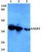 Galanin Receptor 1 antibody, PA5-75748, Invitrogen Antibodies, Western Blot image 