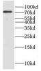 Dihydrouridine Synthase 3 Like antibody, FNab02560, FineTest, Western Blot image 