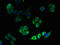 3-Hydroxy-3-Methylglutaryl-CoA Reductase antibody, LS-C285529, Lifespan Biosciences, Immunofluorescence image 