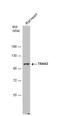 Trafficking Kinesin Protein 2 antibody, NBP2-15370, Novus Biologicals, Western Blot image 