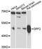 Double PHD Fingers 2 antibody, LS-C748330, Lifespan Biosciences, Western Blot image 