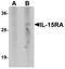 Interleukin 15 Receptor Subunit Alpha antibody, LS-C201047, Lifespan Biosciences, Western Blot image 