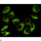 Protein Kinase AMP-Activated Non-Catalytic Subunit Beta 1 antibody, LS-C814091, Lifespan Biosciences, Immunocytochemistry image 