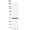 Catechol-O-Methyltransferase antibody, R31326, NSJ Bioreagents, Western Blot image 