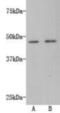 Transmembrane Protein 200A antibody, NBP2-67214, Novus Biologicals, Western Blot image 