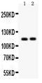 ATPase Sarcoplasmic/Endoplasmic Reticulum Ca2+ Transporting 2 antibody, RP1054, Boster Biological Technology, Western Blot image 