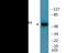 MAP kinase-interacting serine/threonine-protein kinase 1 antibody, EKC2620, Boster Biological Technology, Western Blot image 