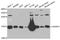 Cellular Retinoic Acid Binding Protein 2 antibody, A03297-2, Boster Biological Technology, Western Blot image 
