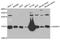 CRABP-II antibody, A03297-2, Boster Biological Technology, Western Blot image 