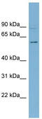 Heat Shock Transcription Factor 5 antibody, TA342413, Origene, Western Blot image 